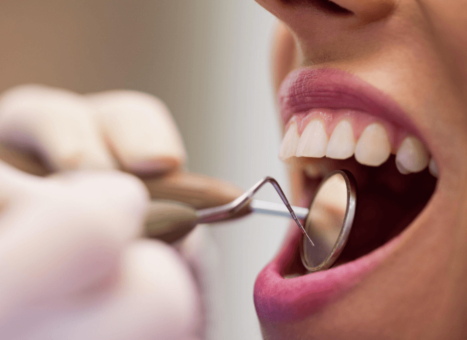 The Benefits of Regular Dental Checkups